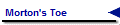 Morton's Toe