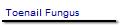 Toenail Fungus